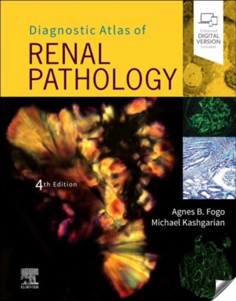 Diagnostic atlas of renal pathology