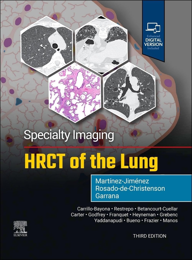 Specialty imaging:hrct of the lung