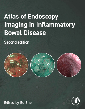 ESSENTIALS OF ENDOSCOPY IMAGING INGLAMMATORY BOWEL DISEASE